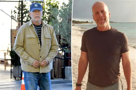 Bruce Willis Latest News Today: Updates on His Health Journey and Legacy