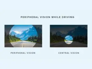 Difficulty with peripheral vision