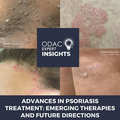 Comprehensive Guide to Psoriasis Treatment Options in the USA