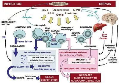 Understanding Septic Shock